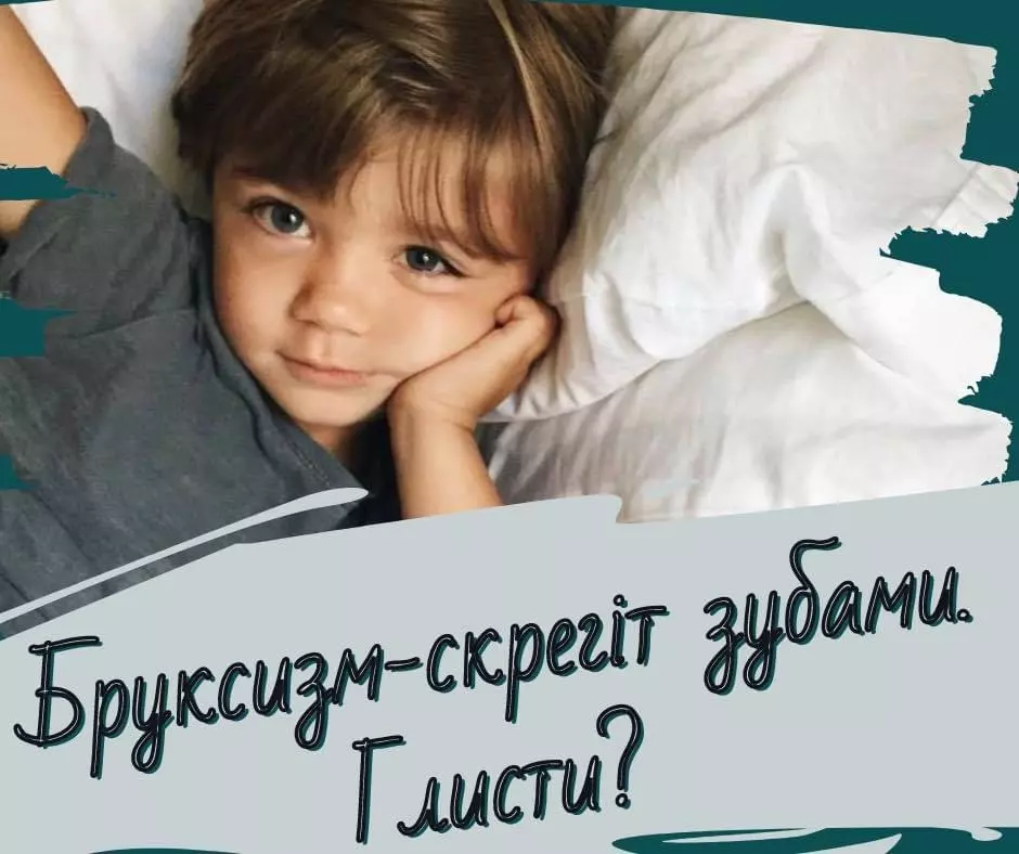 Бруксизм – яке складне слово і яка часта скарга батьків.